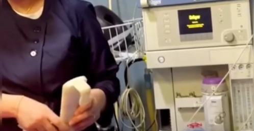 عوارض عمل لابیاپلاستی