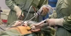 لاپاراسکوپی رحم در کرج