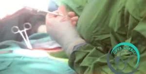 تفاوت لاپاراسکوپی و هیستروسکوپی