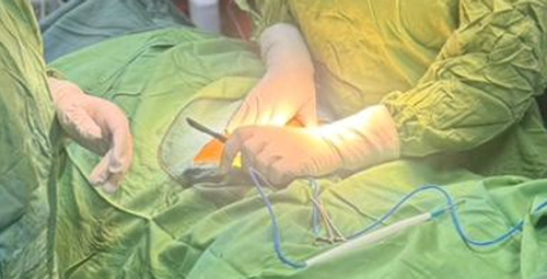 جراحی سرطان دهانه رحم لوگو