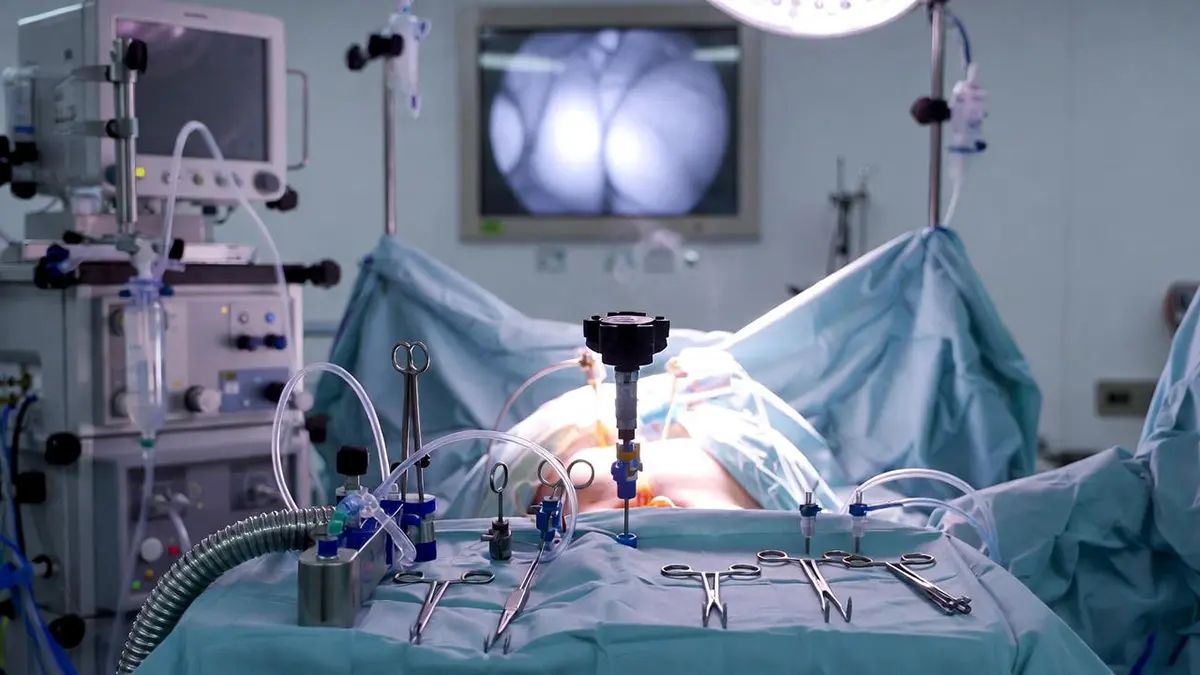 لاپاراسکوپی هیسترکتومی