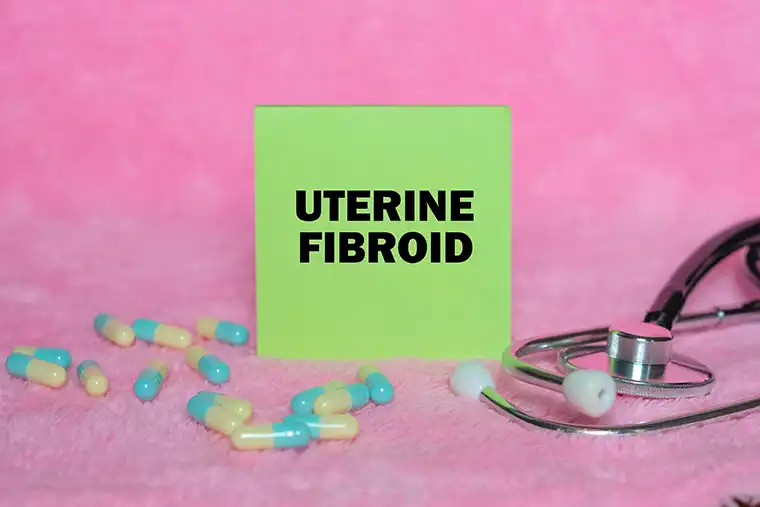 درمانهای دارویی میوم