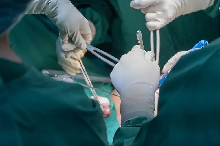 متخصص لاپاراسکوپی در کرج