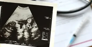 لوگوی IVF