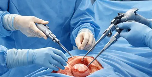 لوگوی مقاله هیسترکتومی