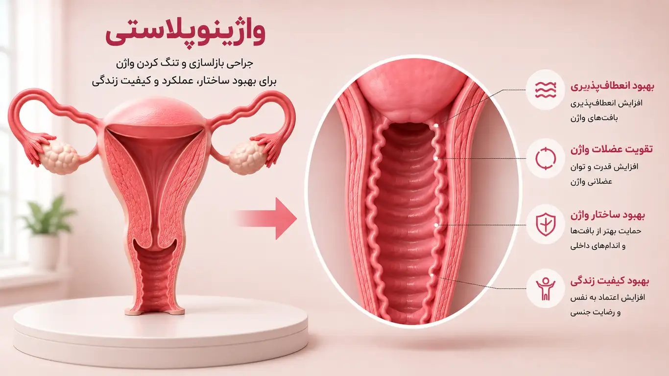 واژینوپلاستی توضیح